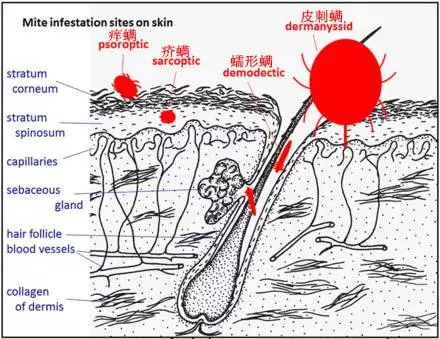 痒螨手绘图片